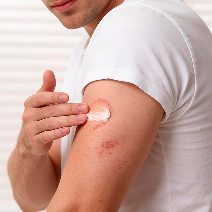 Antifungal Cream for Jock Itch, Athletes Foot & Ringworm - 2% Miconazole Nitrate Cream for Humans Skin Fungus, Relieves Itching, Burning, Cracking and Scaling (3.5 Ounce)