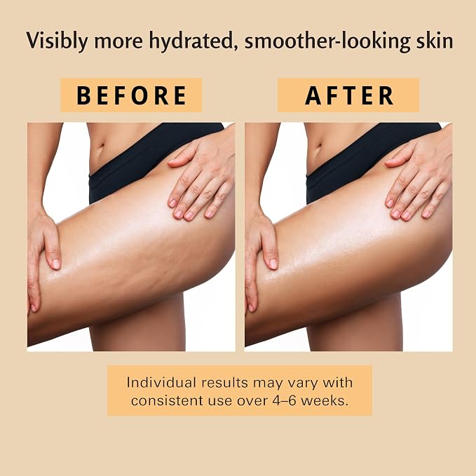 Firming Body Anti-Cellulite Massage Oil with Collagen Helps Smooth the Appearance of Cellulite & Improve Skin Texture – Refreshing Aromatherapy Body Oil for Legs & Full Body 8 fl oz (1pcs)