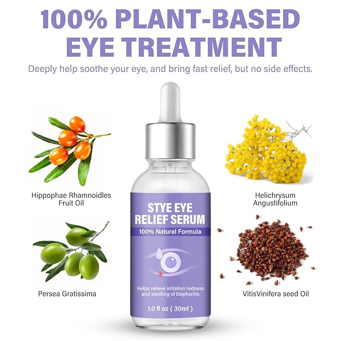 Stye Eye Treatment, Natural Stye Eye Drops for Chalazion and Blepharitis Relief, Gentle Daily Eye Care, Soothes Irritation Redness and Swelling, 1 Fl Oz / 30 Ml
