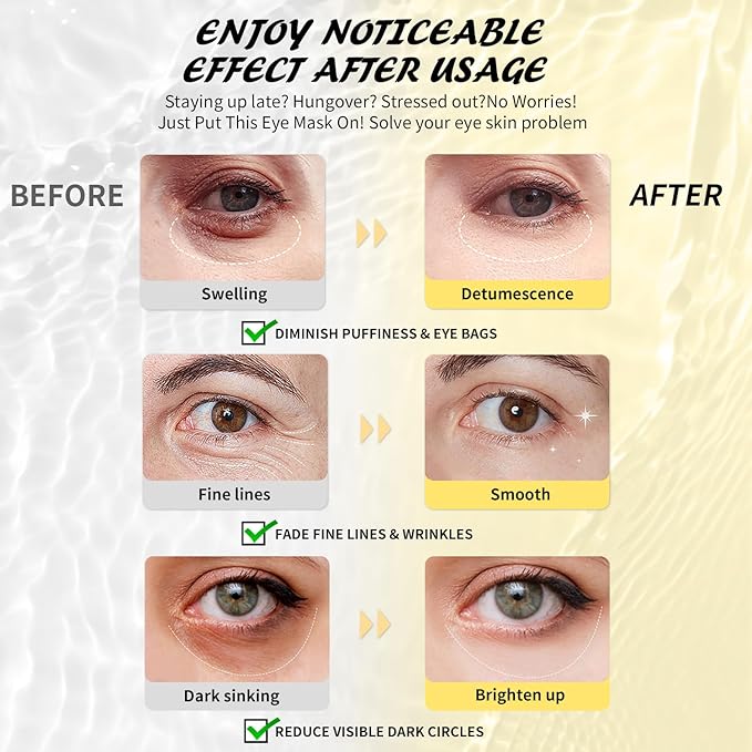 Maskiss Retinol Under Eye Patches (24 Pairs), Purple Eye Masks for Dark Circles, Puffy Eyes & Wrinkles, Firming Collagen Eye Patches, Vegan Cruelty-Free Skincare Gifts for Women