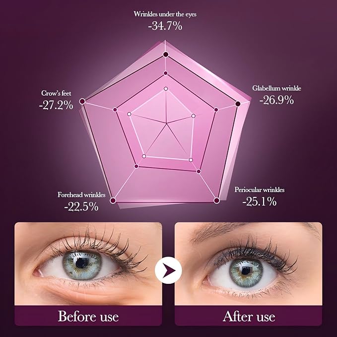 Eye Cream for Dark Circles and Puffiness - Anti Aging Eye Cream for Wrinkles and Fine Lines, Hydrating Under Eye Cream with Snail Secretion Filtrate & Hydrolyzed Collagen, 0.7oz