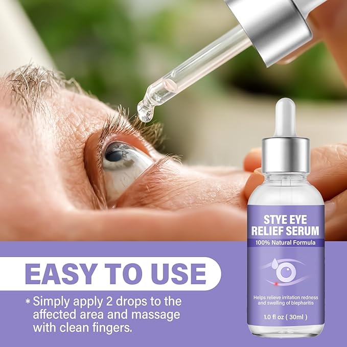 Stye Eye Treatment, Natural Stye Eye Drops for Chalazion and Blepharitis Relief, Gentle Daily Eye Care, Soothes Irritation Redness and Swelling, 1 Fl Oz / 30 Ml