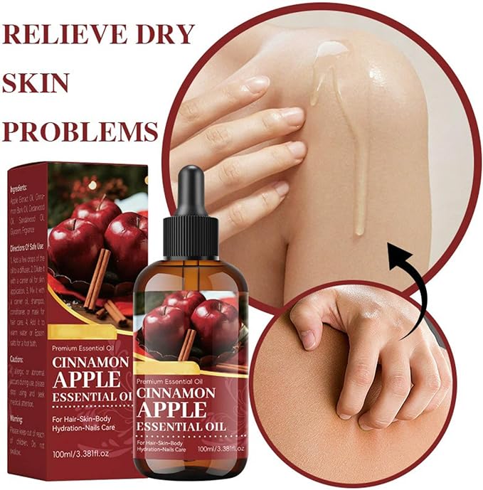 Apple Cinnamon Essential Oil, Natural Scented Diffuser Oil with Dropper for Aromatherapy, Natural Candle Making & Soap Making Scents, Hair Care, Face, Skin Care & Body Massage for Home, Office 3.53oz