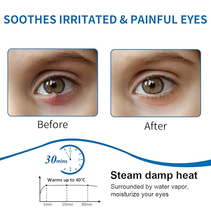 12 Count Stye Eye Treatment | Heated Eye Mask, Unscented Steam Warm Compress for Dry Eyes, Self-Heating Moist Eye Compress, Blepharitis & Chalazion & Overnight Stye Eye, Puffiness & Tired Eyes