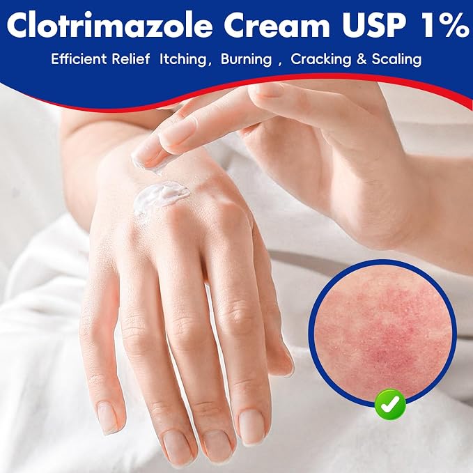 Clotrimazole Antifungal Cream 1% USP (1 oz), Anti Fungal Treatment, Relieves Itching, Burning, Cracking and Scaling Associated Athletes Foot
