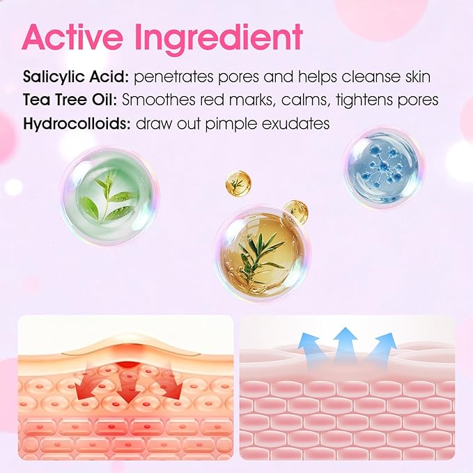 AUSLKA Star-Heart Pimple Patches for Face, Cute Zit Patches for Trip, Holiday, Dates Makeup, Mixed Shapes Zit Stickers with Salicylic Acid 216 Pcs