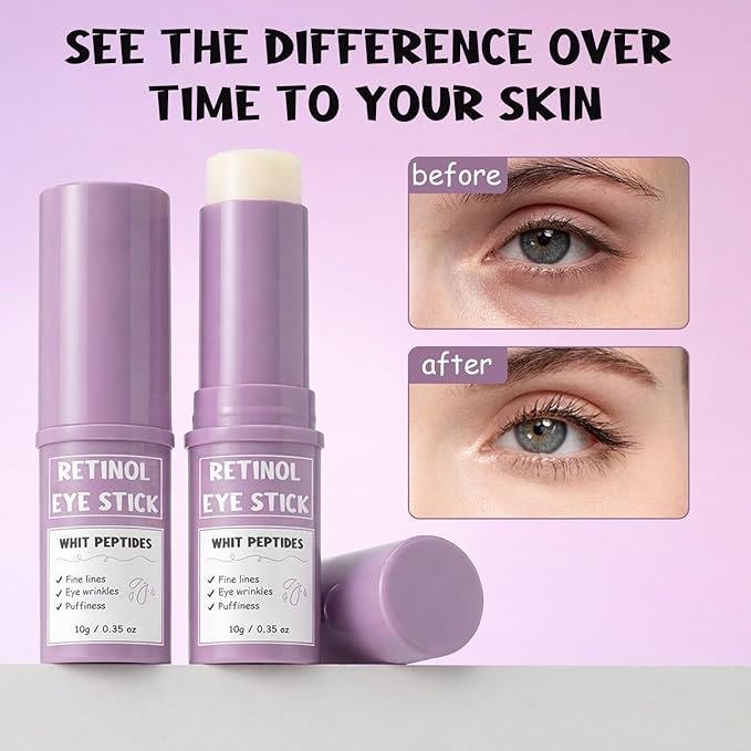 Retinol Eye Stick, Anti-Aging Under Eye Cream & Eye Balm Stick for Dark Circles and Fine Lines, Hydrating Eye Wrinkle Cream with Peptides, Travel-Friendly Eye Care for Smoother-Looking Skin, 0.38 oz