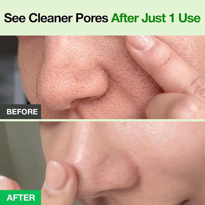 FULLY Green Tomato Pore Clay Mask Cleanser for Deep Cleansing, 4.05 fl oz | Clay Pack Cleanser for Deep Pore Cleansing, Blackhead & Sebum Control, Gentle Korean Face Wash for Oily & Combination Skin