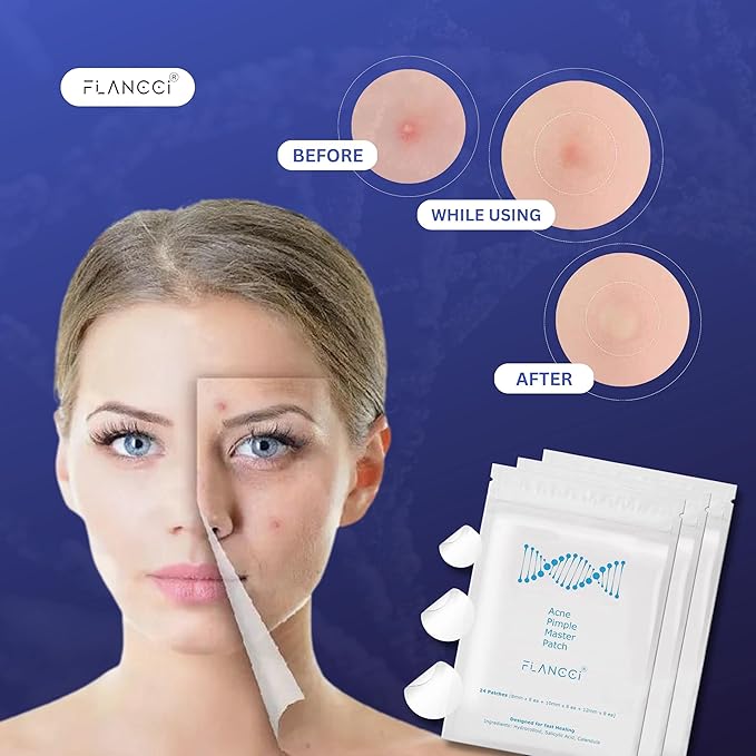 FLANCCI Pimple Patch Acne Patches Facial Skin Care Products, Blackhead Remover, Pimple Patch for Face and Hydrocolloid Acne Treatment Patch Salicylic Acid, Acne Spot Treatment (120 Count (Pack of 5))