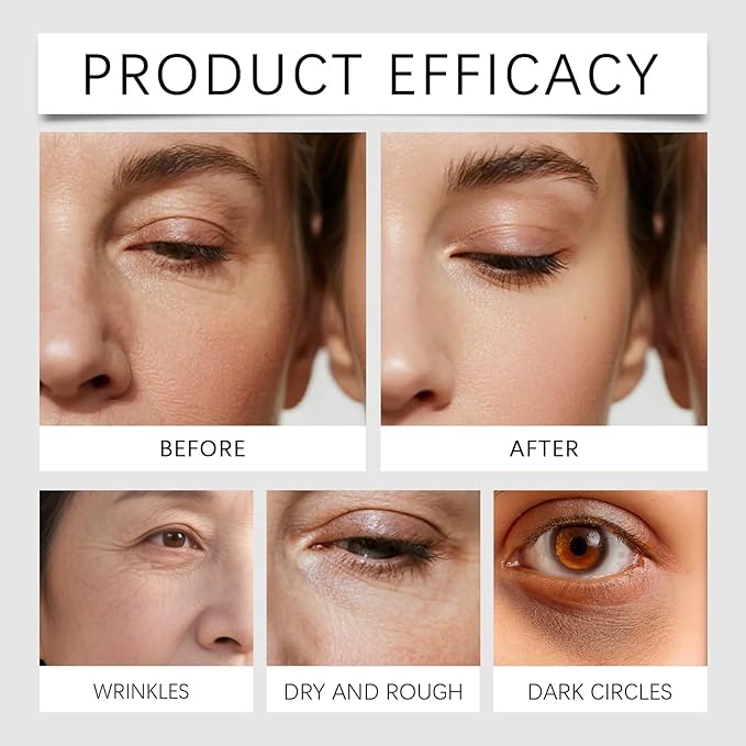 Calcium Volume Eye Patch with Rebornic 10,000ppm & Hydrolyzed Elastin – 60 Patches for Puffiness Relief, Fine Lines, Firming & Lifting, Hydrating Eye Patches for Face and Neck Care