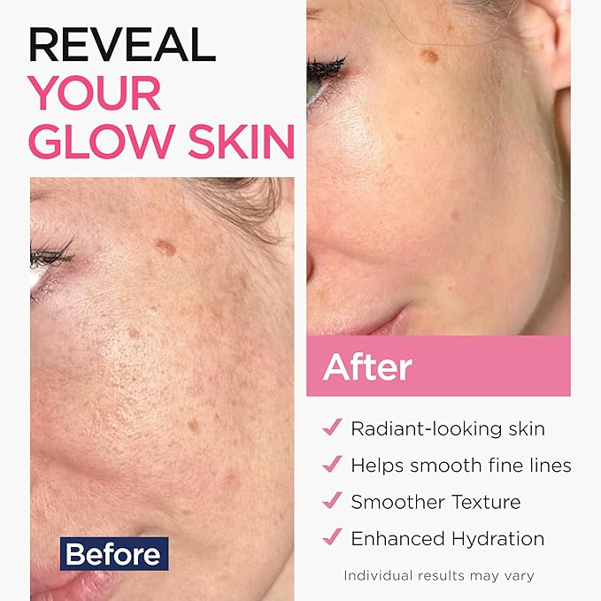 Retinol Serum for Face (2Oz) with Hyaluronic Acid, Vitamin E & Aloe Vera - Anti-Aging Serum