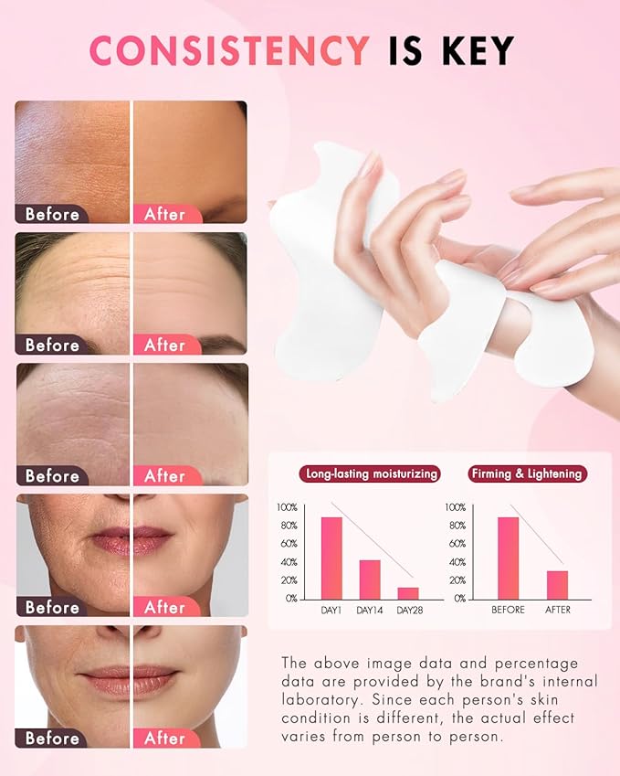 UKVOA Forehead Wrinkle Patches & Smile Line Patches, Overnight Facial Wrinkle Treatment with Hyaluronic Acid, Aloe, Collagen & Vitamin E to Lift Smile Lines for Women 72pcs