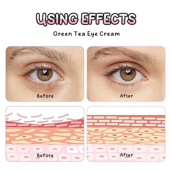 AKARY Green Tea Under Eye Cream with Triple-roller Massage, Advanced Formula with Kohhii Ekisu, Moisturizing, Firming, Smooth Wrinkle, Tighten skin, Even Tone for Dark Circles & Bags, Fine Lines