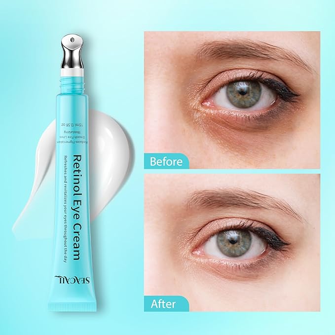Retinol Eye Cream - Anti Aging Under Eye Cream with Hyaluronic Acid & Caffeine, Eye Serum for Dark Circles & Puffiness, Reduces Wrinkles & Repairs Eye Area (15ml)