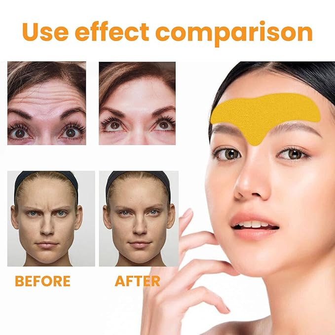 Forehead Wrinkle Remover Patch,Smooth Forehead And Smooth Fine Lines And Wrinkles,Lift Facial Skin Forehead Patch,Forehead Patches for Wrinkles With Hydrolyzed Collagen And Centella Asiatica,Suitable