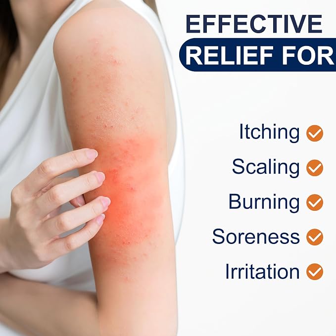 Antifungal Cream for Jock Itch, Athletes Foot & Ringworm - 2% Miconazole Nitrate Cream for Humans Skin Fungus, Relieves Itching, Burning, Cracking and Scaling (3.5 Ounce)