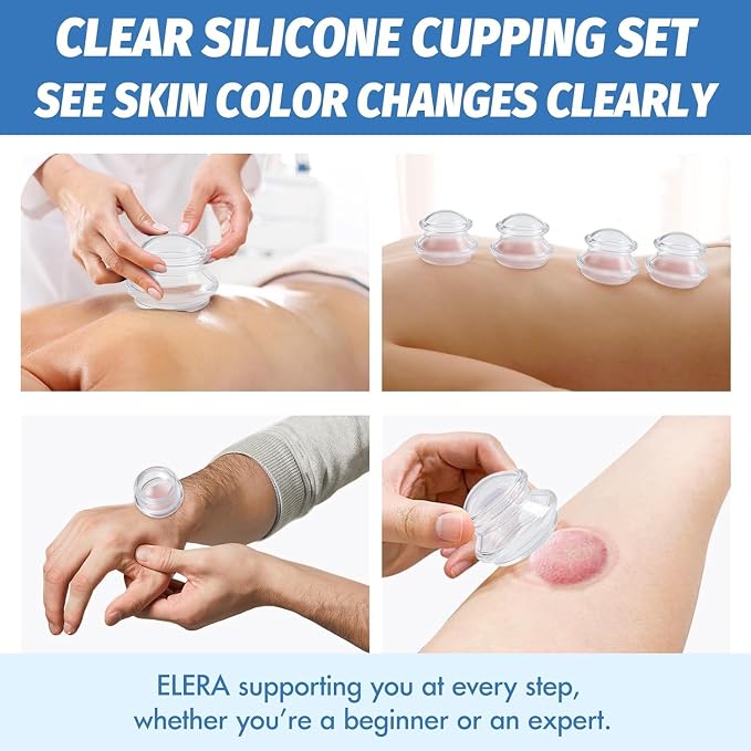 ELERA Silicone Cupping Therapy L Size Sets, Professionally Chinese Massage Cups Tools, Silicone Cup for Joint Pain Relief, Massage Body (L*2 Cups)