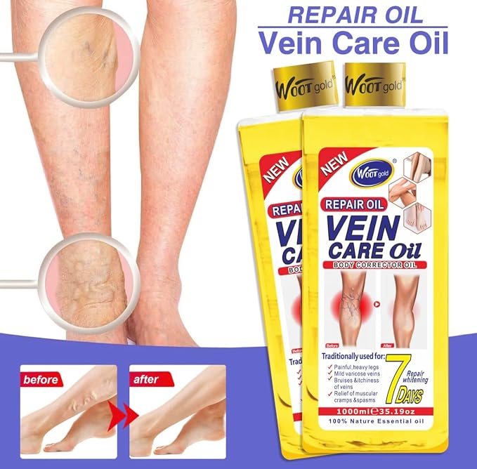 Vein Care Oil, Repair Oil for Painful Heavy Legs, Mild Varicose Veins, Bruises, Itchiness, Cramps, 35.19 oz