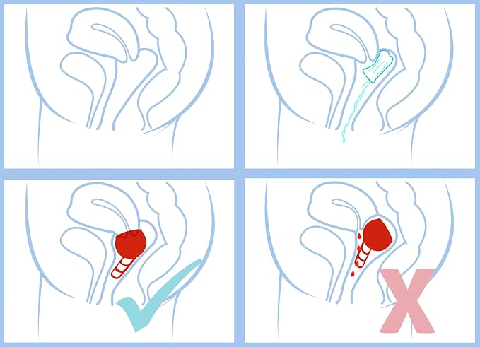 Merula Cup Vampire - One Size Menstrual Cup from Medical Grade Silicon