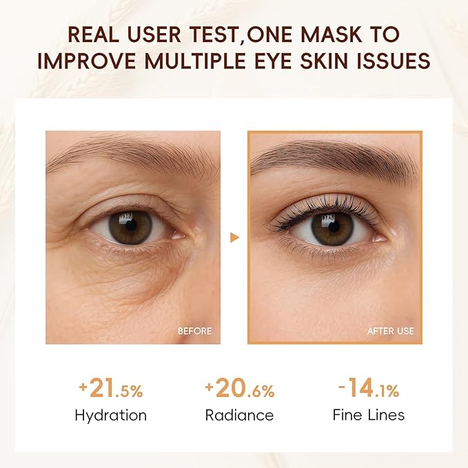 AKARY 5Pcs 94.4% Triple Rice Ferment Complex Under Eye Masks, Moisturizing, Firming, Glowing, Deeply Nourishing, Skin Moisture Barrier, Improve & Firm Eye Skin Eue Pathes for Dark Circles & Fine Lines