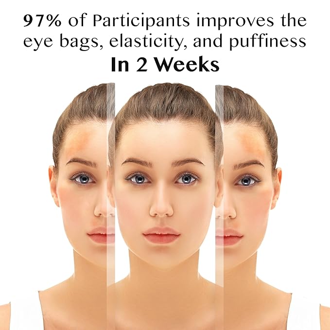 Lamelin Eye Cream Roller, Collagen & Peptides for Total Eye Lift, Rapid Wrinkle Repair, Dark Circle & Under Eye Bag Treatment, Anti-Aging & Hydrating Formula, 1.01 Fl Oz. Made In Korea....