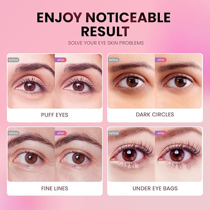 AILEORY Under Eye Patches (36 Pairs) - Tri-color Glitter Eye Gel Pads for Dark Circles, Puffy Eyes, Under eye Bags, Wrinkles | Natural Collagen Under Eye Mask Patches, Mothers Day Gifts for Mom