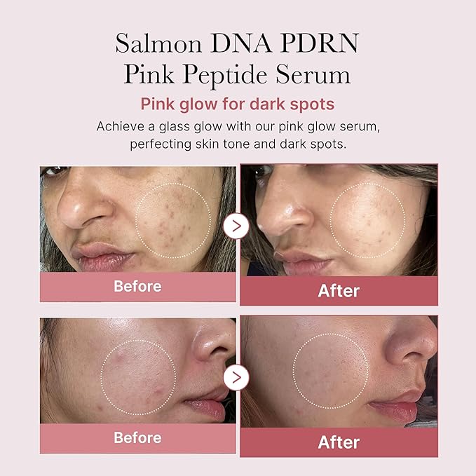 medicube PDRN Peptide Serum Duo for Face & Eye: PDRN Peptide Eye Serum and Salmon DNA Facial Serum for Radiant, Plump Skin | Korean Skincare, Gifts for Women, Skin Care Set