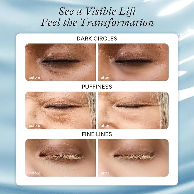 In My Eyes Hydrating Under Eye Patches 5 Pairs - Hyaluronic Acid Hydrogel Eye Masks, Depuffing Anti-Wrinkle for Dark Circles Fine Lines Puffiness, Self Care Gifts for Women & Teenage Girls