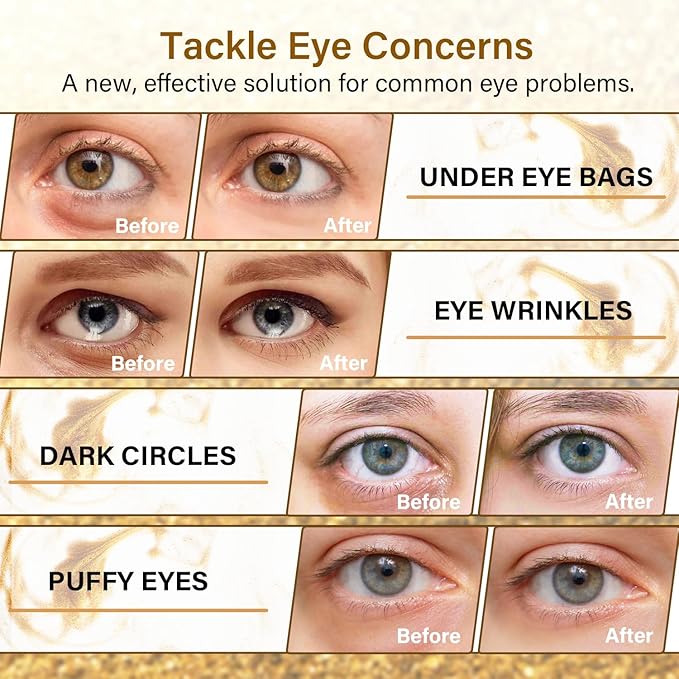 Gold Cucumber Under Eye Patches - 60 Pairs Hydrogel Eye Mask for Dark Circles & Wrinkles with Collagen, Hyaluronic Acid & Castor Oil, Hydrating & Smoothing Treatment