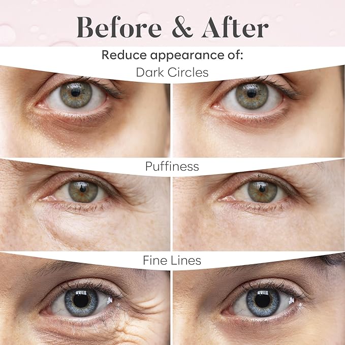 AURAE Rose Under Eye Patches (30 Pairs) - Under Eye Mask for Appearance of Dark Circles - For Puffy Eyes Smoothing - Skincare Mask