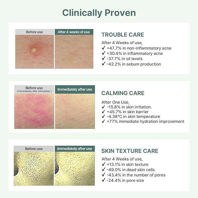 AROCELL Cica Hydrogel PDRN Mask 7 Facial Sheet with Panthenol & Centella Asiatica, Cooling Hydrogel Face Mask for Soothing Calming Hydrating Moisturizing Sensitive Skin Korean Skincare, 25gx7ea