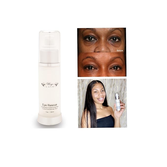 Non Comedogenic Eye Cream - Eye cream anti aging, Puffy Eyes Anti Aging Vitamin C, E & Collagen Shea butter Reduce Dark Circles, Puffiness, Under Eye Bags, Wrinkles & Fine Lines for Men & Women,dark circles under eye treatment for women,eye brightening...
