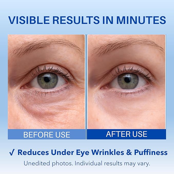 Instant Under Eye Lift Serum – Fast-Acting Firming Formula to Reduce Eye Bags, Wrinkles, Puffiness & Dark Circles | Advanced Polysaccharide Technology for Mature Skin – 20 mL (Fragrance Free)