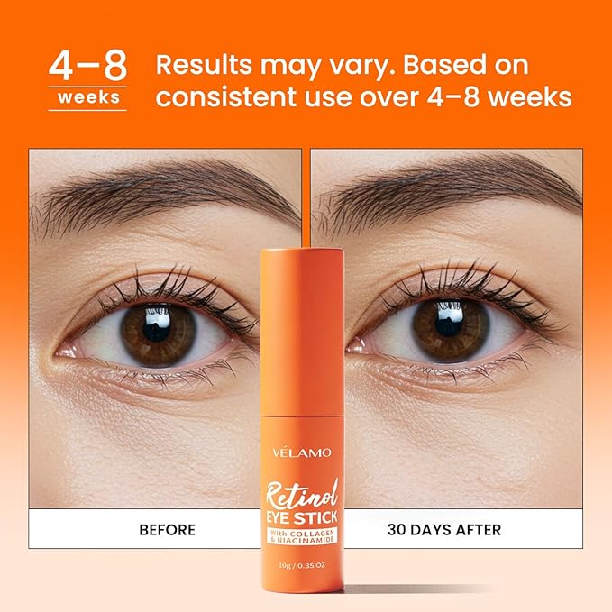 VELAMO ADVANCED Luminous Eye Corrector SPF 41(Shade: Medium) & Upgraded Retinol Under Eye Balm with Collagen Duo: for Dark Circles, Fine Lines & Puffiness - Hydrating Anti Aging Under Eye Cream