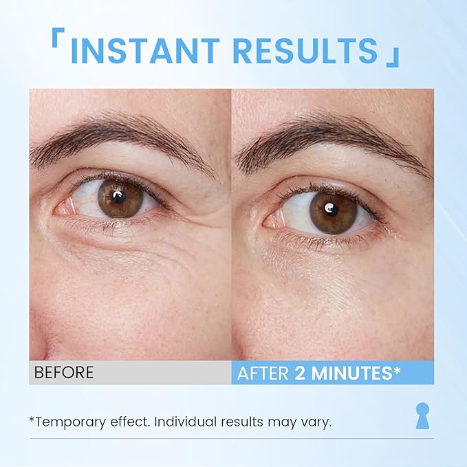 RONKIE Instant Eye Lift Cream: Reduces Eye Bags Wrinkles Puffy Eyes Dark Circles Crow’s Feet in Minutes for Mature Skin of Middle-aged Women 1 Fl Oz (Light)