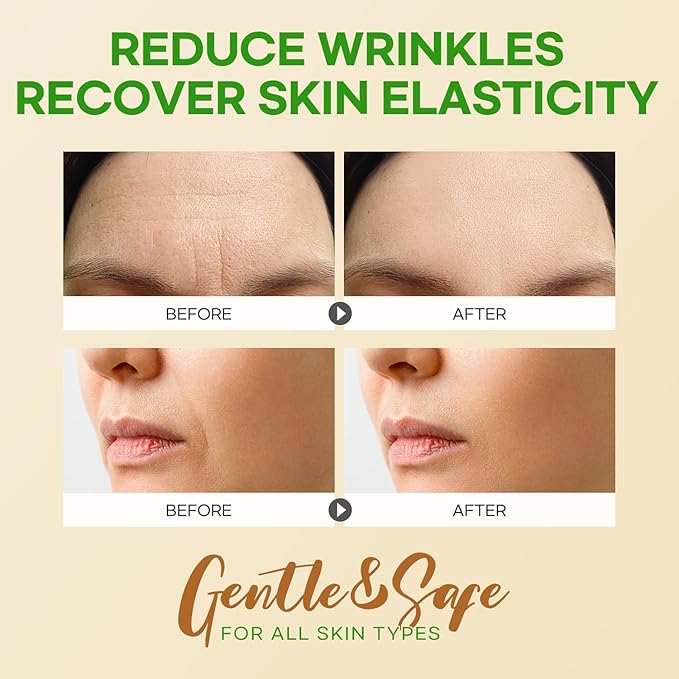 SILKDERMIS Smile Line and Forehead Wrinkle Patches: Smile Line Treatment with Aloe, Collagen, Vitamin E-Forehead Patches 12pcs, Smile Line Patches 24pcs