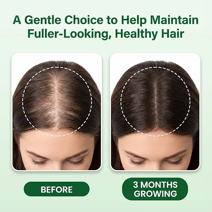 Hair Growth Care Serum Roll-On with Rosemary, Niacinamide, Amino Acids, Ginger, Biotin, Castor Oil, Batana & Caffeine, Nourishes Scalp for Thicker-Looking, Healthy Glow Hair, 30ml