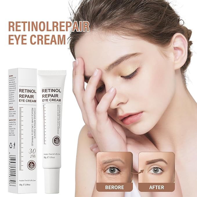 Retinol Eye Cream for Dark Circles and Puffiness – Eye Cream Anti Aging to Reduce Wrinkles & Fine Lines, Firm and Hydrate Under Eyes, Revitalizing Eye Treatment 30g/1oz