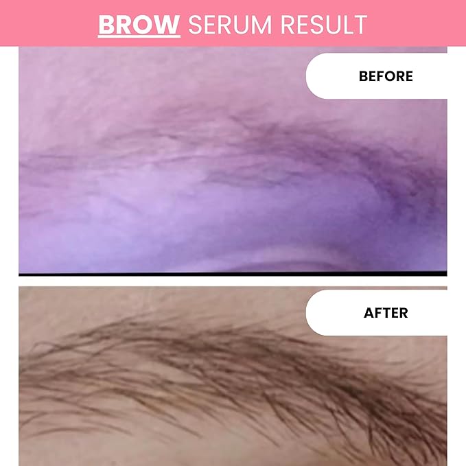 nuorganic Cosmic Lash & Brow Serums for Growth | Thicker, Longer, More Defined Lashes & Brows | 4-Month Supply XL Size | Made in USA, Cruelty-Free, cGMP Certified, 8ml Each