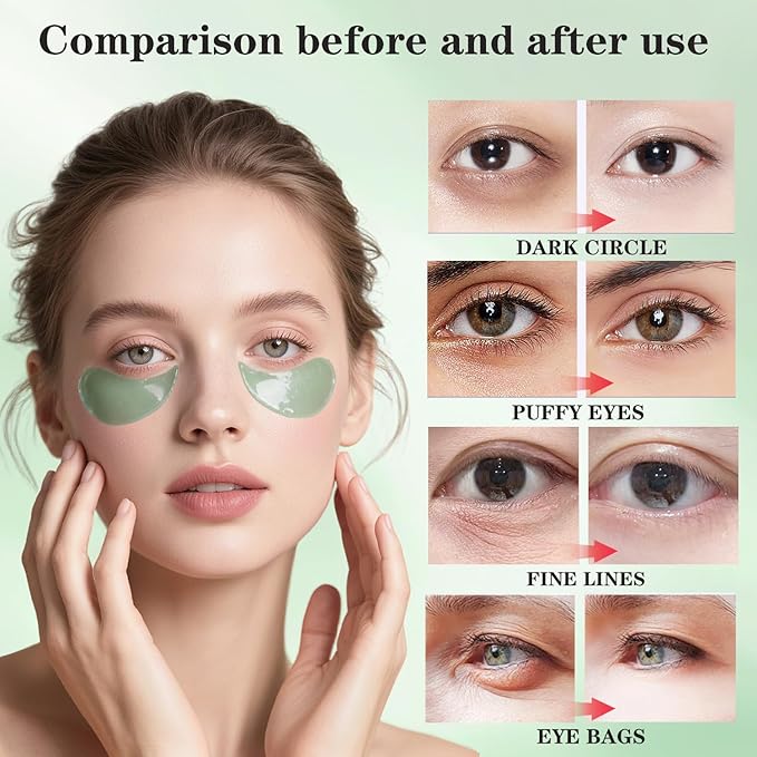 Seaweed Brightening Under Eye Patches (80 Pieces) with Collagen & Hyaluronic Acid, Moisturizing Eye Mask Gel Pads for Eye Bags, Fine Lines,Dark Circle,Puffiness, Bridesmaid Birthday Gifts for Women
