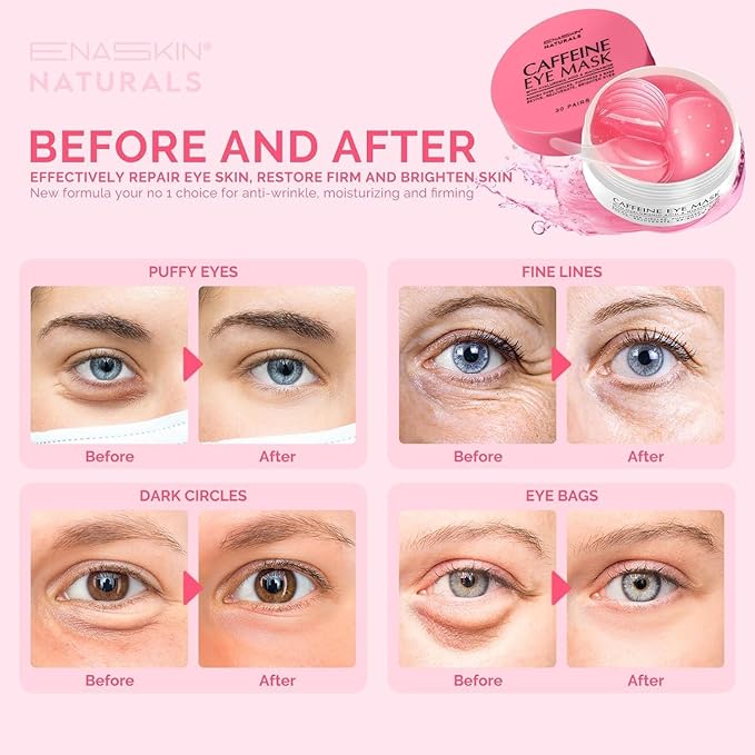 Under Eye Patches for Puffiness and Dark Circles: Caffeine Gel Masks for Undereye Wrinkles Bags - Instant Moisturizing Brightening Skincare Pads - Gift for Women Mom Wife - 30 Pairs (Rose)