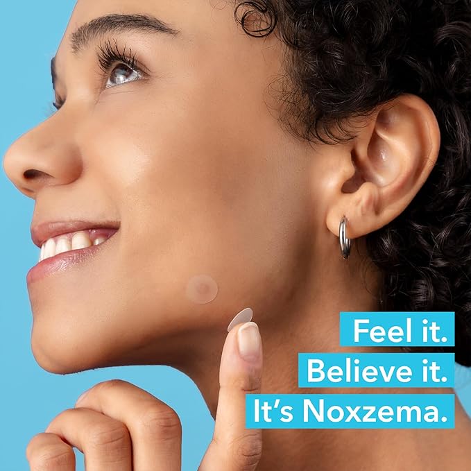 Noxzema Blemish Patches, Ultimate Clear – Hydrocolloid Acne Treatment for Face with Niacinamide and Tea Tree Oil, 30 Patches/Box (90 Total)