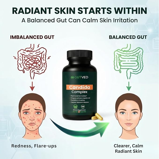 Candida Complex with Caprylic Acid for Men & Women – Anti Overgrowth, Balance and Restore Supplement for Yeast, Healthy Gut Flora & Skin with 30B/g Probiotic, Oregano, Senna - 1 Month Supply
