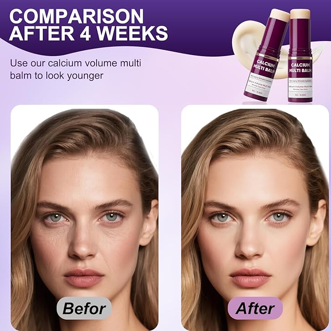 2Pcs Calcium Multi Balm, Wrinkle Multi Balm Stick, Repair & Moisturizing Cream, All-in-One Hydrating Firming Lip Eye Neck Cream, Anti-aging for Face, 0.32 oz/9 g