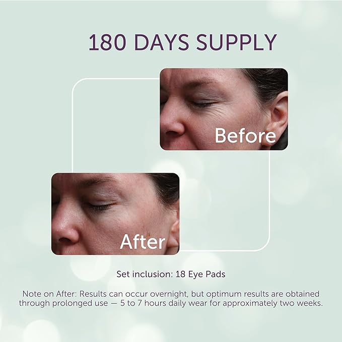 Silc Skin Silicone Eye Pads Reusable Overnight Eye Patches, Medical Grade Silicone For Fine Lines And Puffiness, 180 Day Supply