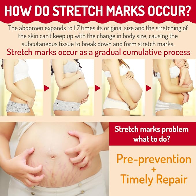 Stretch Mark Oil for Pregnancy Massages Body & Reduces Scar Appearance, Removes Stretch Mark Prevention, Prenatal & Postnatal Tummy Skin Care, Firming Skin Elasticity for Maternity, 2.03oz(Pack of 2)