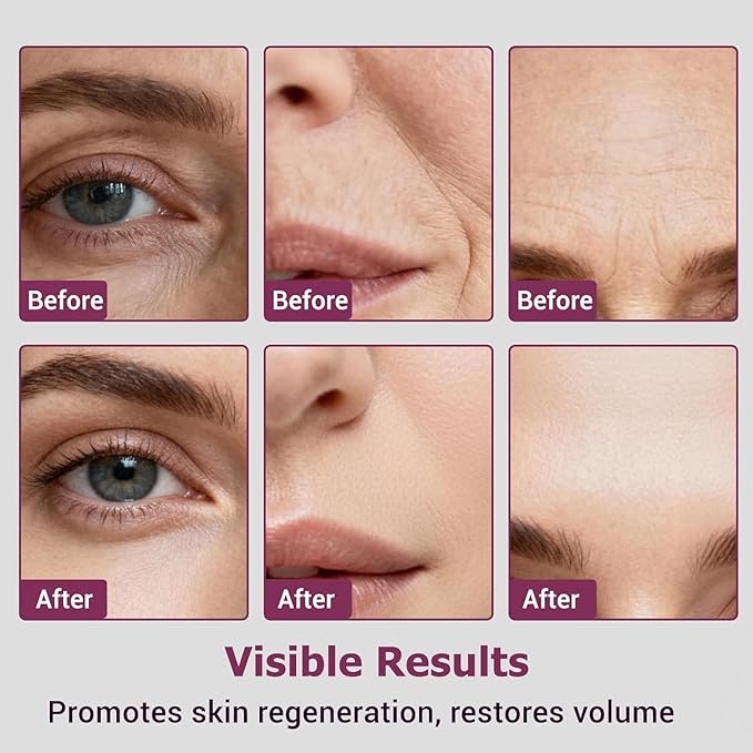Calcium Multi Balm Stick, Calcium Volume Multi Balm, Under Eye Balm, Korean Collagen Hydrating & Moisturizing Stick, Anti-Aging, Firming Skin, Reduce Fine Lines, Suitable for Face, Eyes, Neck (1)