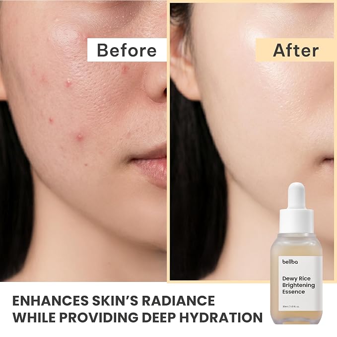 Dewy Rice Glow Serum Korean Serum for Face - K-beauty Skincare Rice Brightening Essence - Get Even Tone and Glass Skin - Hydrating, Lightweight, Non-Comedogenic (1 fl.oz)