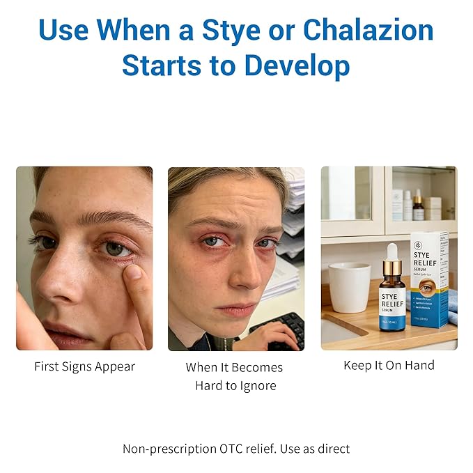 Stye Eye Treatment Product, Relief for Styes, Chalazions, Blepharitis, Dry Eyes, Irritation and Swelling; Clear Eyes Redness Relief, Eye Stye Treatment, Soothing Eyelid Comfort, 30ml 1 Fl Oz