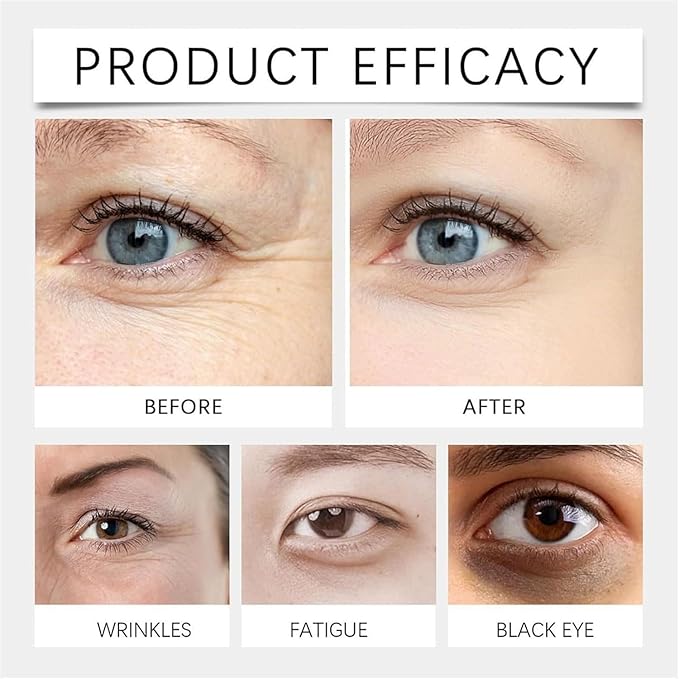 Lutein Eye Essence Oil, Ruy Vc Anti-Wrinkle Eye Serum Oil, Hydrating Under Treatment for Fine Lines, Puffiness & Dark Circles – 15ml (3)